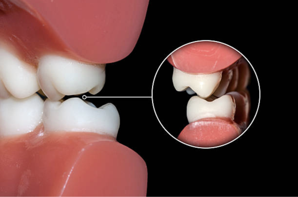 Orthodontics Portage MI