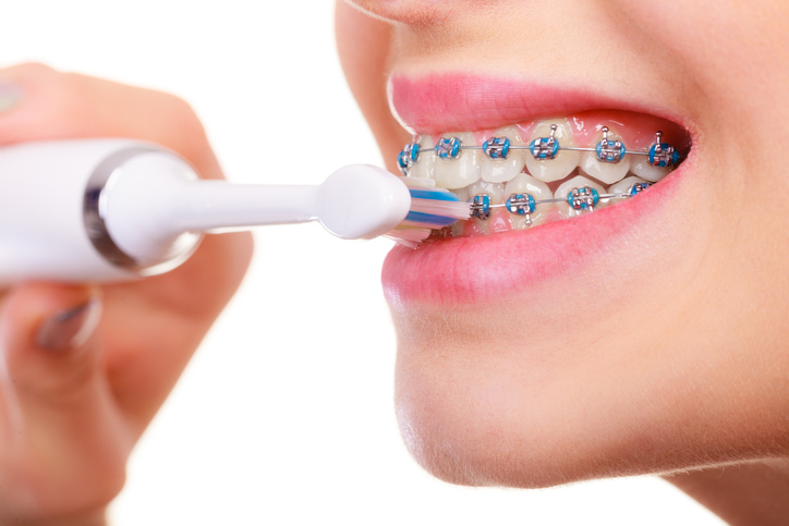 How Much Do Braces Cost?  Grand Rapids MI Orthodontists